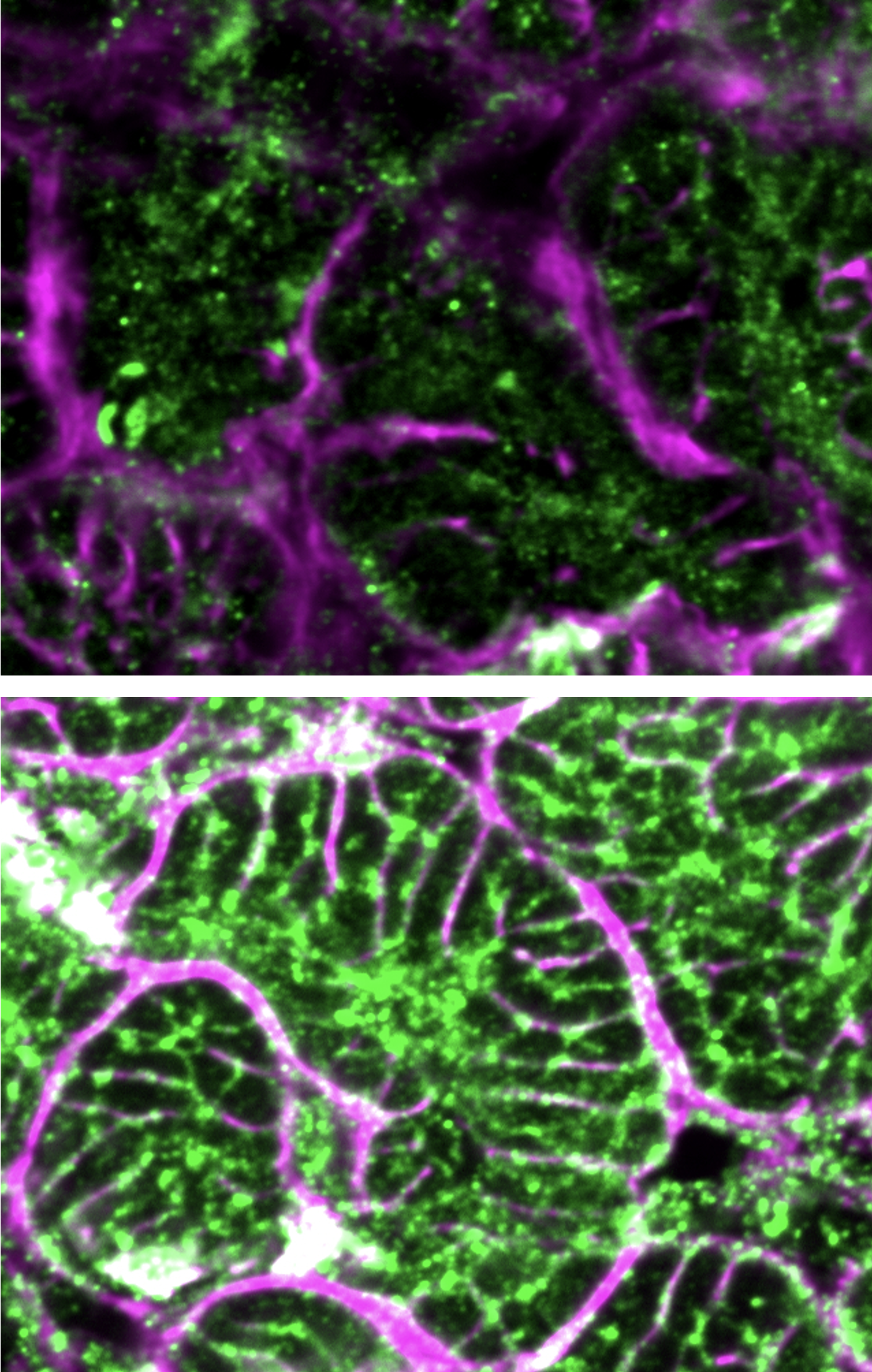 Two microscope images of heart cells labeled in magenta and green on a black background. The lower image is much brighter and less disorganized.