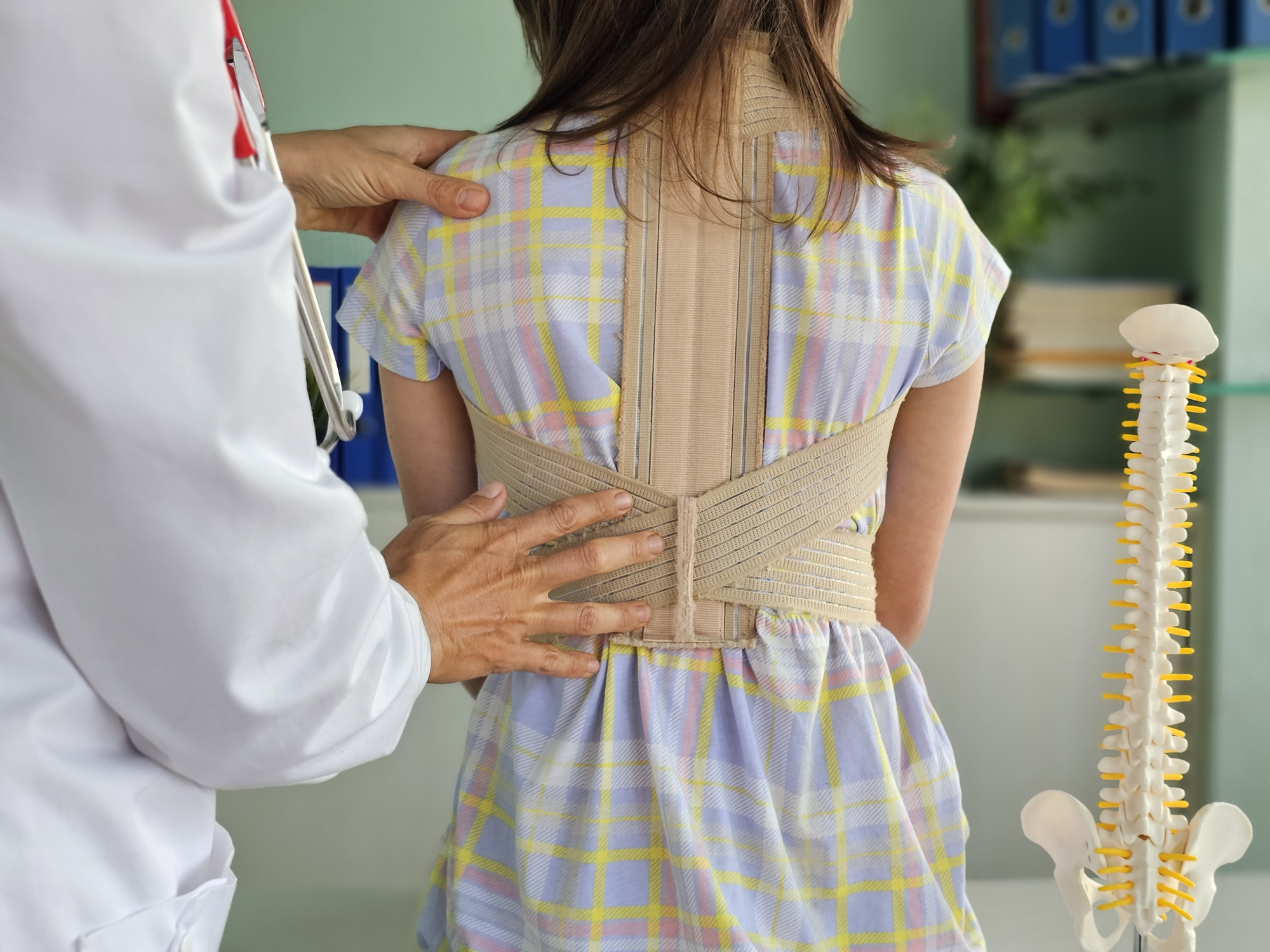How Scoliosis Bracing Can Prevent Surgery in Children