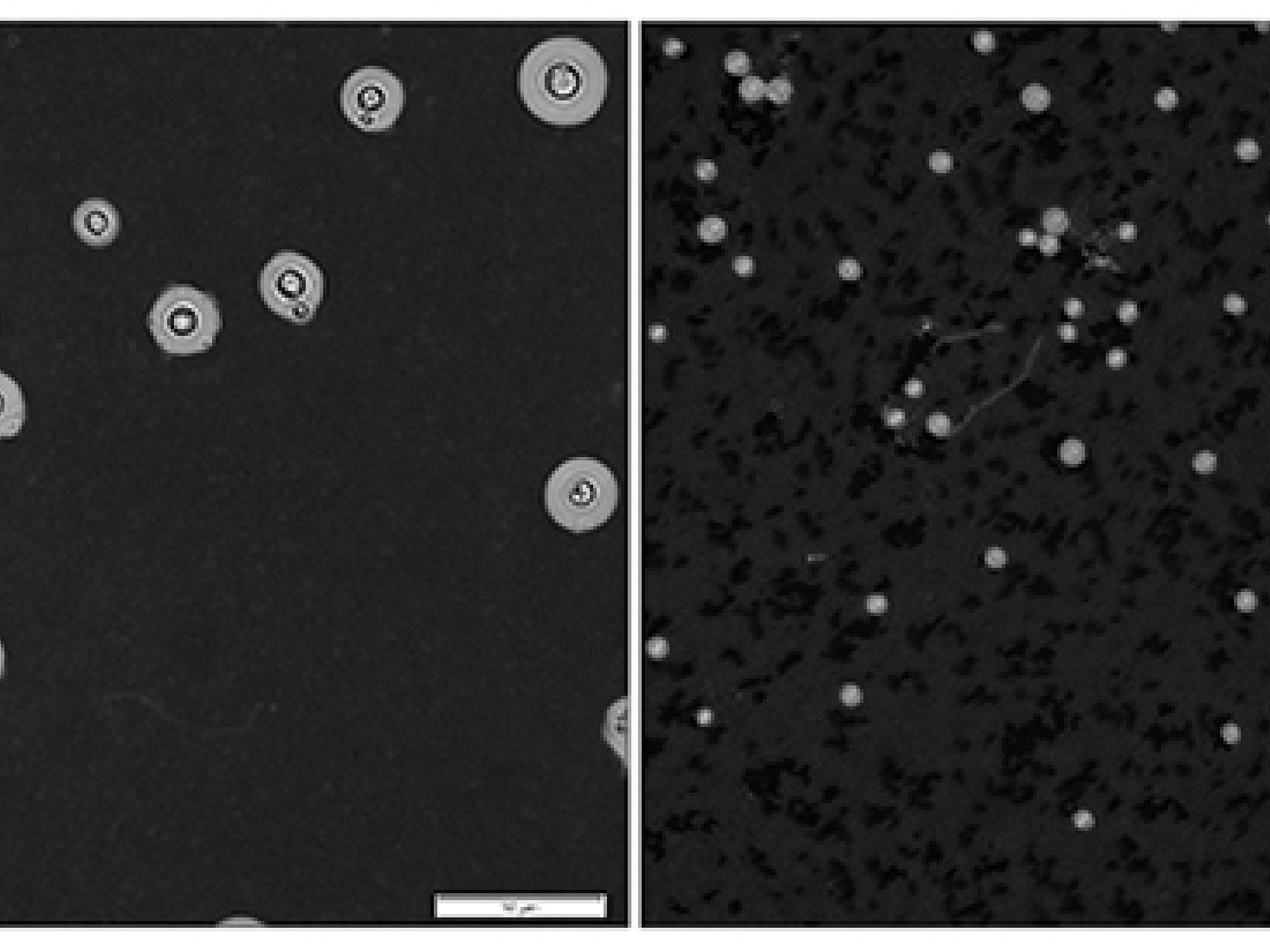 Cryptococcus